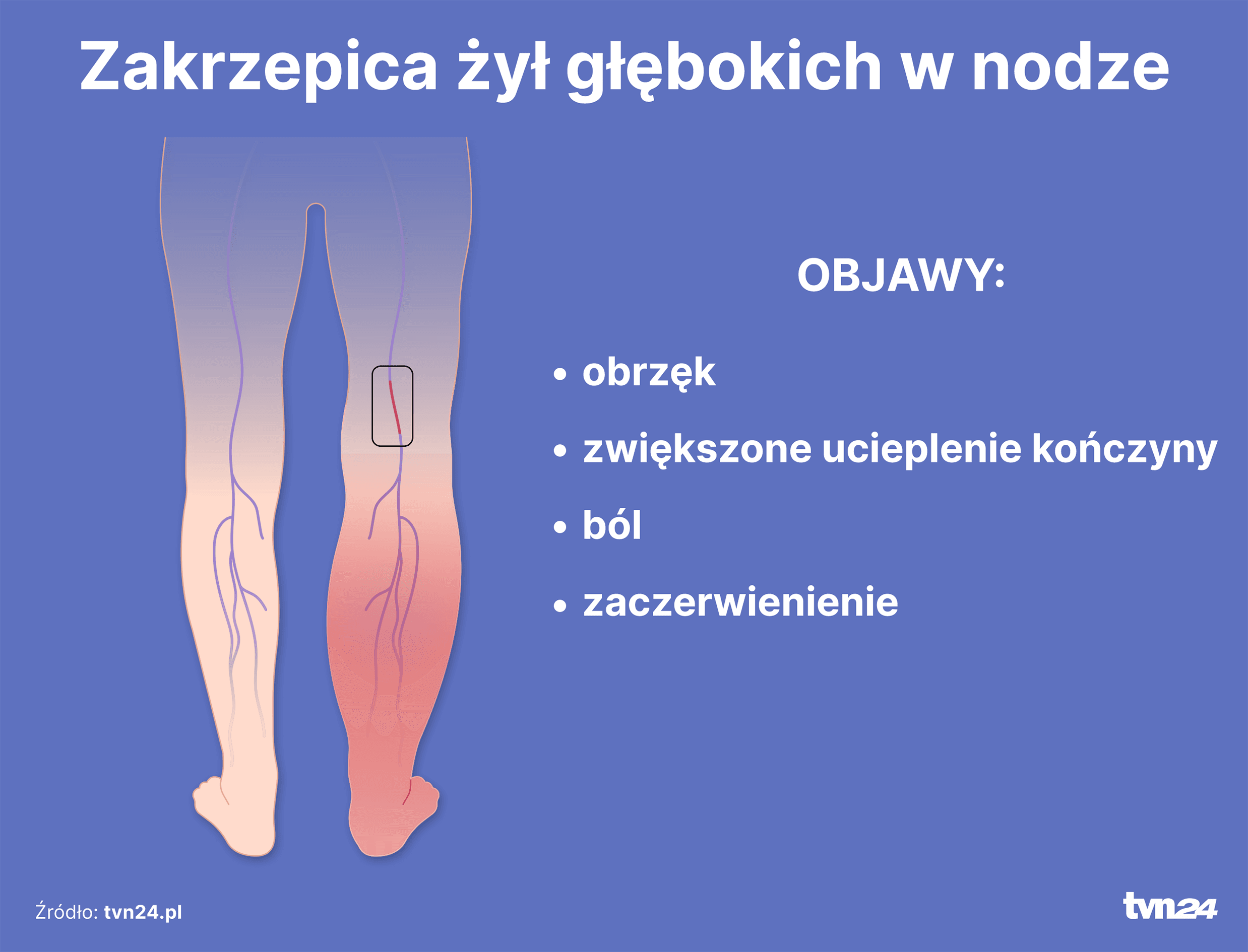 Objawy zaburzeń krzepnięcia krwi: Krwotok czy zakrzep? Sprawdź!